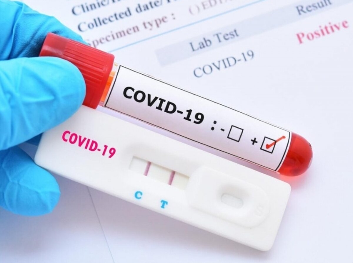 Over One Million Covid Tests Applied in Jalisco